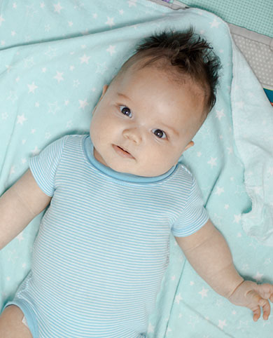 Causas de la asimetría craneal en bebés